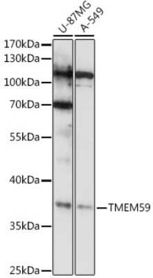 Western Blot: TMEM59 AntibodyAzide and BSA Free [NBP3-04988]